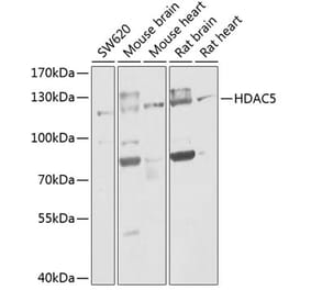 Western Blot - Anti-HDAC5 Antibody (A80436) - Antibodies.com