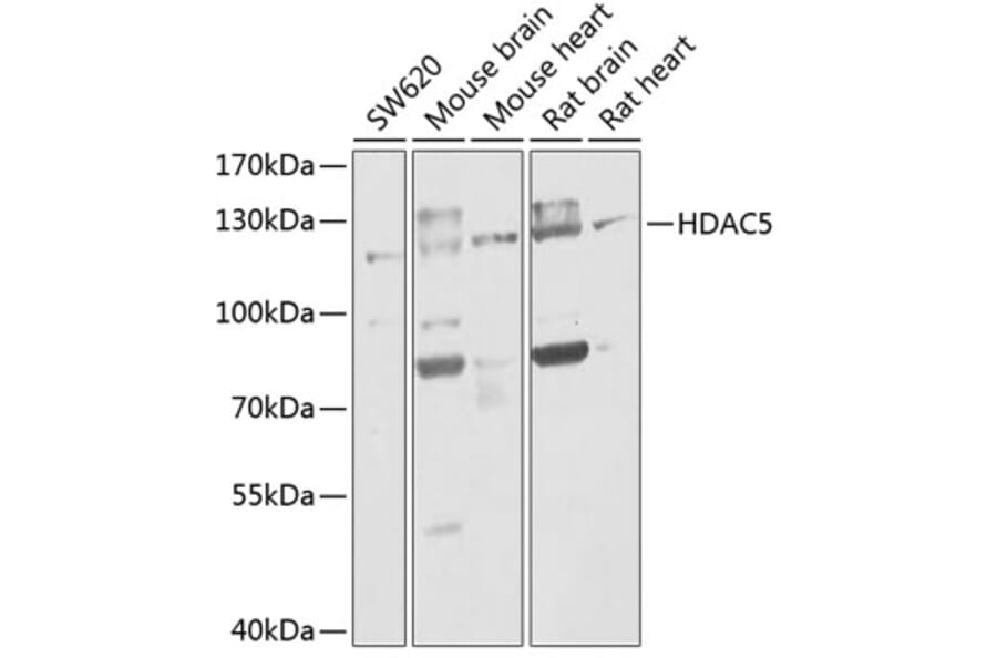 Western Blot - Anti-HDAC5 Antibody (A80436) - Antibodies.com