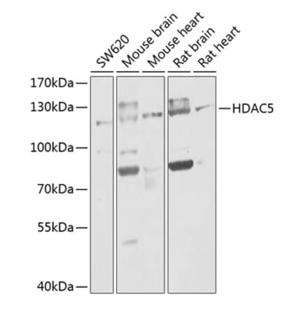 Western Blot - Anti-HDAC5 Antibody (A80436) - Antibodies.com