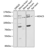 Western Blot - Anti-HDAC5 Antibody (A80436) - Antibodies.com