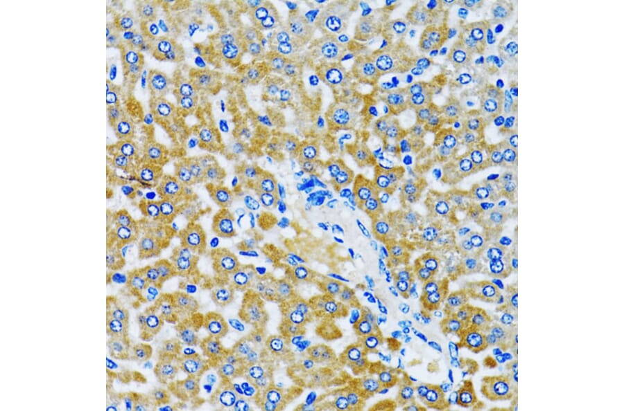 Immunohistochemistry - Anti-HDAC5 Antibody (A80436) - Antibodies.com