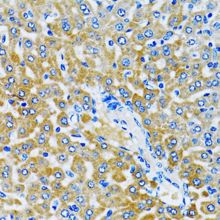 Immunohistochemistry - Anti-HDAC5 Antibody (A80436) - Antibodies.com