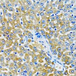 Immunohistochemistry - Anti-HDAC5 Antibody (A80436) - Antibodies.com