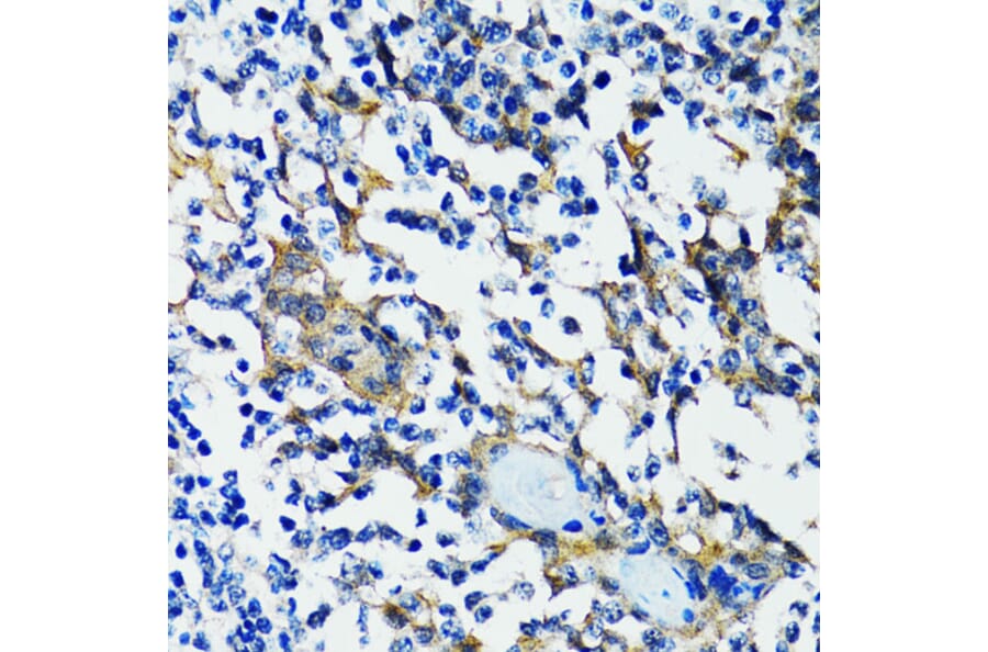 Immunohistochemistry - Anti-HDAC5 Antibody (A80436) - Antibodies.com