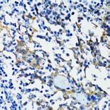 Immunohistochemistry - Anti-HDAC5 Antibody (A80436) - Antibodies.com