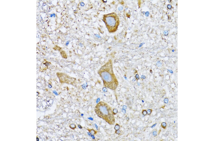 Immunohistochemistry - Anti-HDAC5 Antibody (A80436) - Antibodies.com