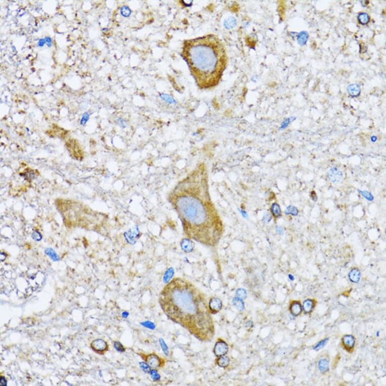 Immunohistochemistry - Anti-HDAC5 Antibody (A80436) - Antibodies.com