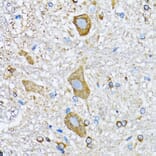 Immunohistochemistry - Anti-HDAC5 Antibody (A80436) - Antibodies.com