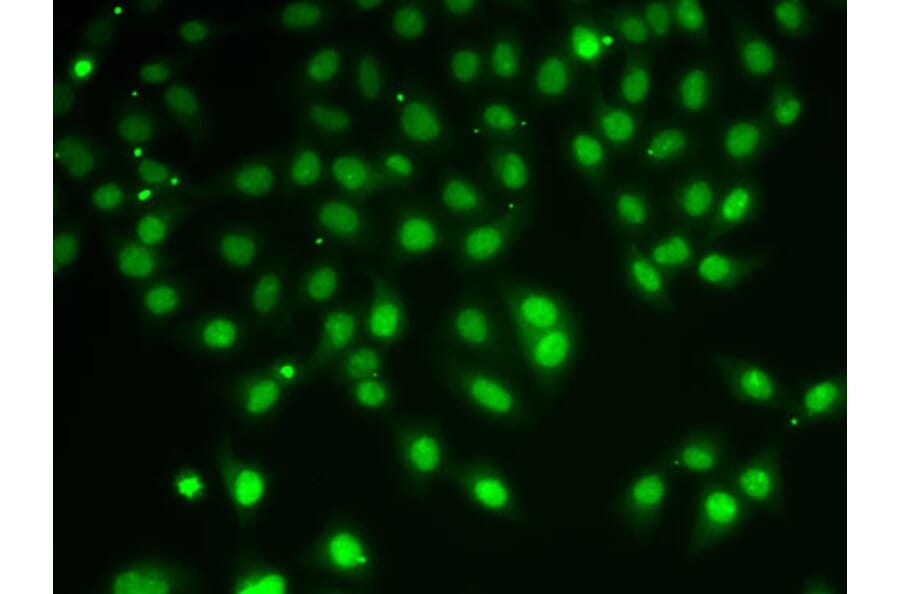 Immunofluorescence - Anti-HDAC5 Antibody (A80436) - Antibodies.com