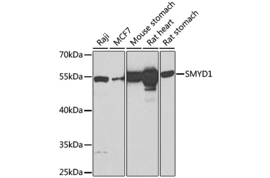 Western Blot - Anti-SMYD1 Antibody (A80437) - Antibodies.com