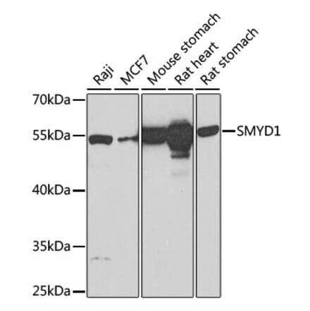 Western Blot - Anti-SMYD1 Antibody (A80437) - Antibodies.com