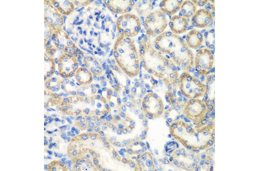 Immunohistochemistry - Anti-SMYD1 Antibody (A80437) - Antibodies.com