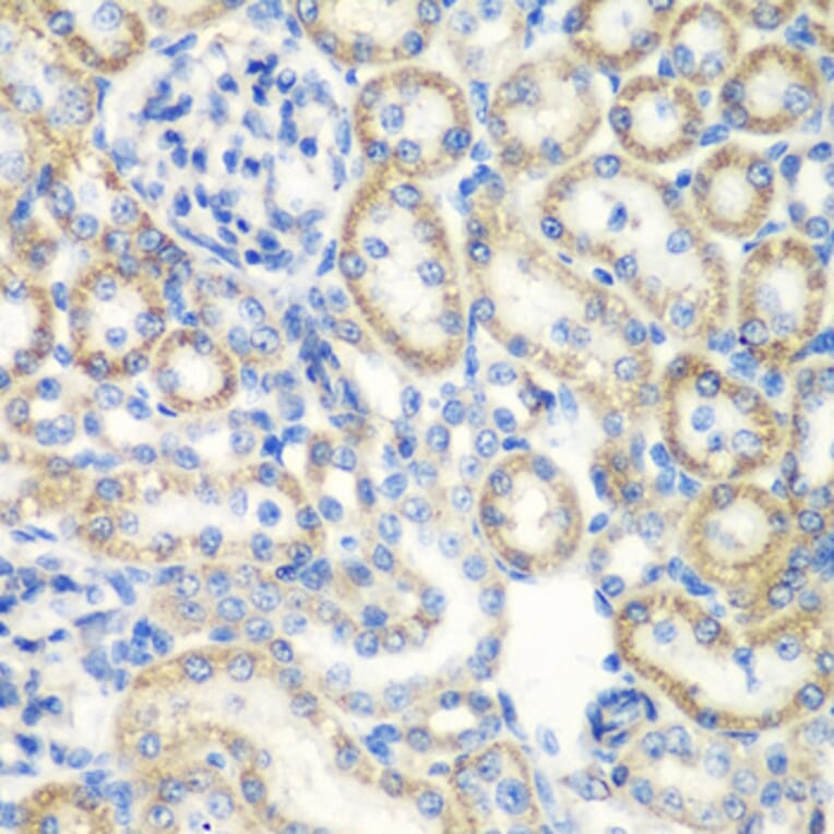 Immunohistochemistry - Anti-SMYD1 Antibody (A80437) - Antibodies.com