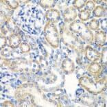 Immunohistochemistry - Anti-SMYD1 Antibody (A80437) - Antibodies.com