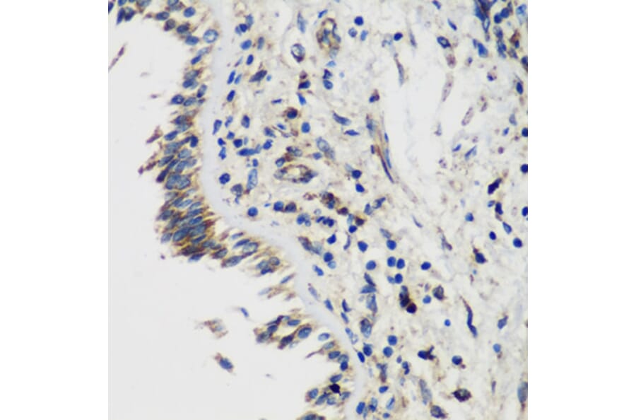 Immunohistochemistry - Anti-SMYD1 Antibody (A80437) - Antibodies.com