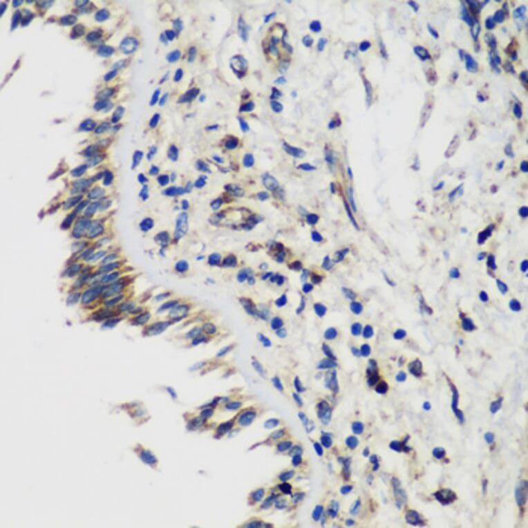 Immunohistochemistry - Anti-SMYD1 Antibody (A80437) - Antibodies.com