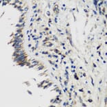 Immunohistochemistry - Anti-SMYD1 Antibody (A80437) - Antibodies.com