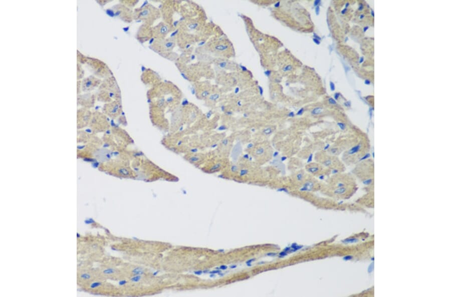 Immunohistochemistry - Anti-SMYD1 Antibody (A80437) - Antibodies.com