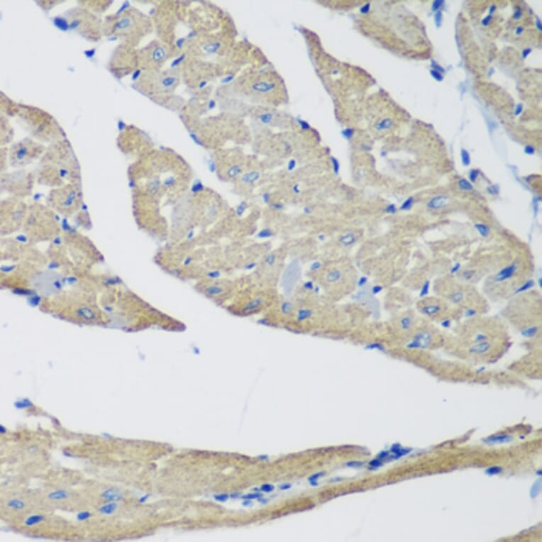 Immunohistochemistry - Anti-SMYD1 Antibody (A80437) - Antibodies.com