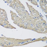 Immunohistochemistry - Anti-SMYD1 Antibody (A80437) - Antibodies.com