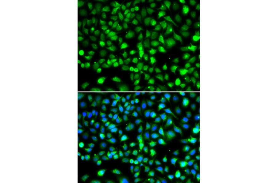 Immunofluorescence - Anti-SMYD1 Antibody (A80437) - Antibodies.com