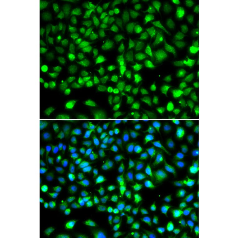 Immunofluorescence - Anti-SMYD1 Antibody (A80437) - Antibodies.com