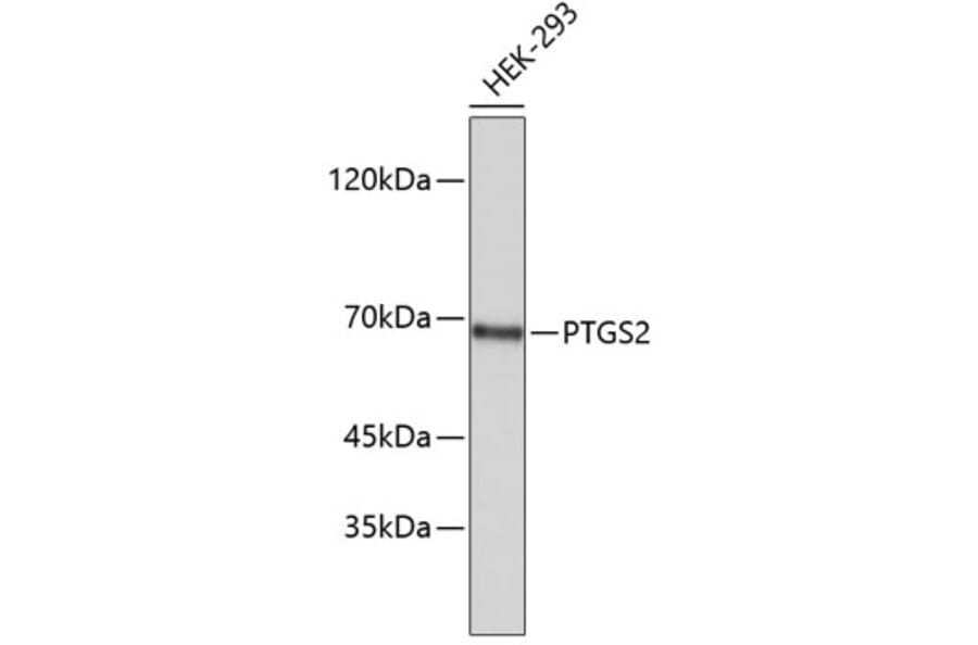 Western Blot - Anti-PTGS2 Antibody (A5787) - Antibodies.com