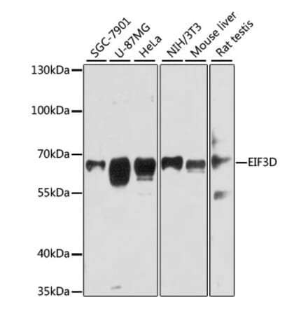 Western Blot - Anti-EIF3D Antibody (A80439) - Antibodies.com