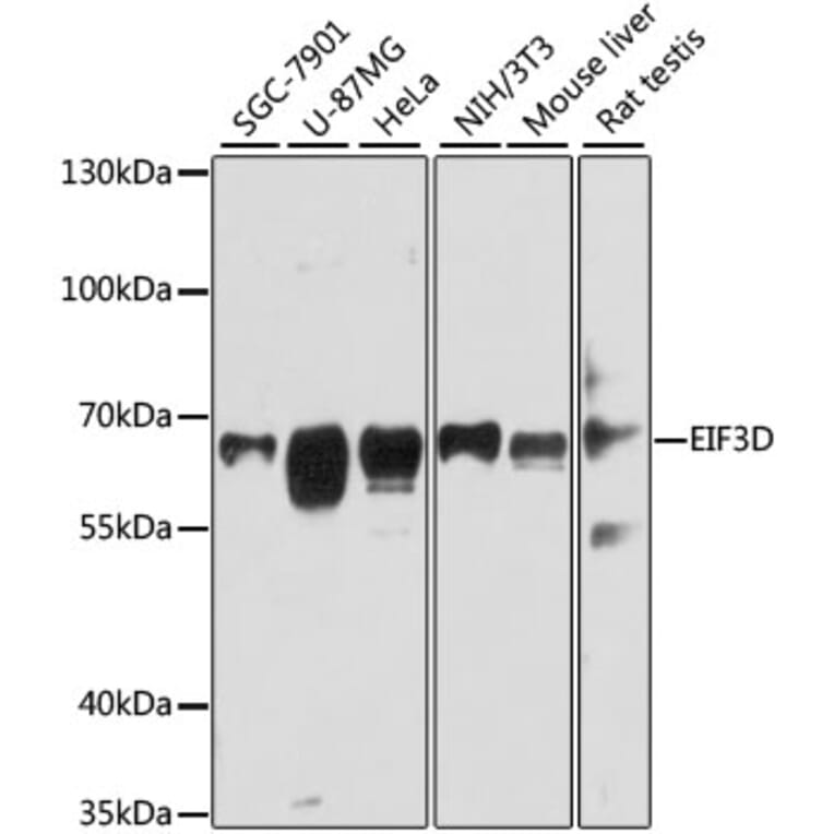 Western Blot - Anti-EIF3D Antibody (A80439) - Antibodies.com