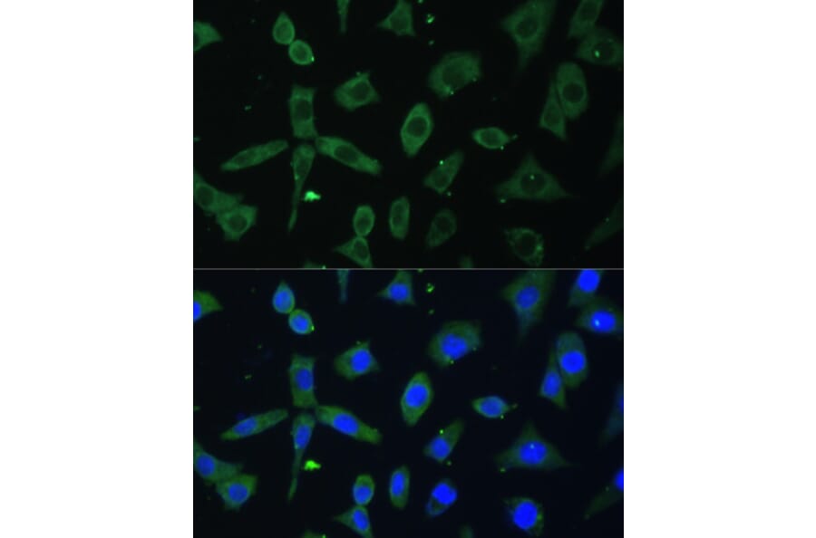 Immunofluorescence - Anti-EIF3D Antibody (A80439) - Antibodies.com