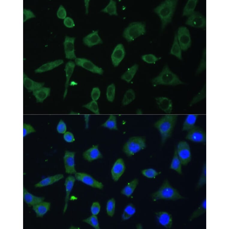 Immunofluorescence - Anti-EIF3D Antibody (A80439) - Antibodies.com