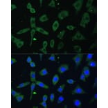 Immunofluorescence - Anti-EIF3D Antibody (A80439) - Antibodies.com