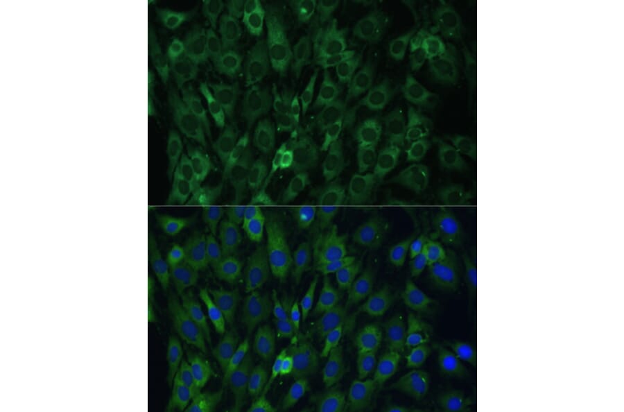 Immunofluorescence - Anti-EIF3D Antibody (A80439) - Antibodies.com
