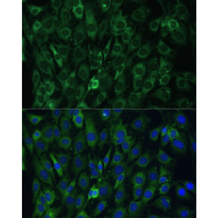 Immunofluorescence - Anti-EIF3D Antibody (A80439) - Antibodies.com