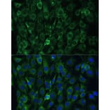 Immunofluorescence - Anti-EIF3D Antibody (A80439) - Antibodies.com