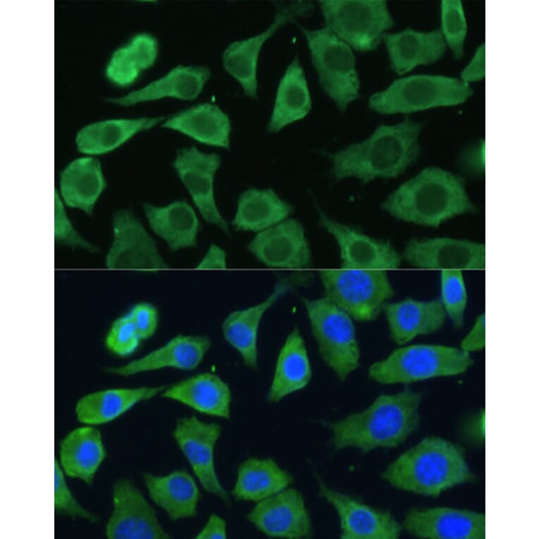 Immunofluorescence - Anti-EIF3D Antibody (A80439) - Antibodies.com