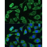 Immunofluorescence - Anti-EIF3D Antibody (A80439) - Antibodies.com