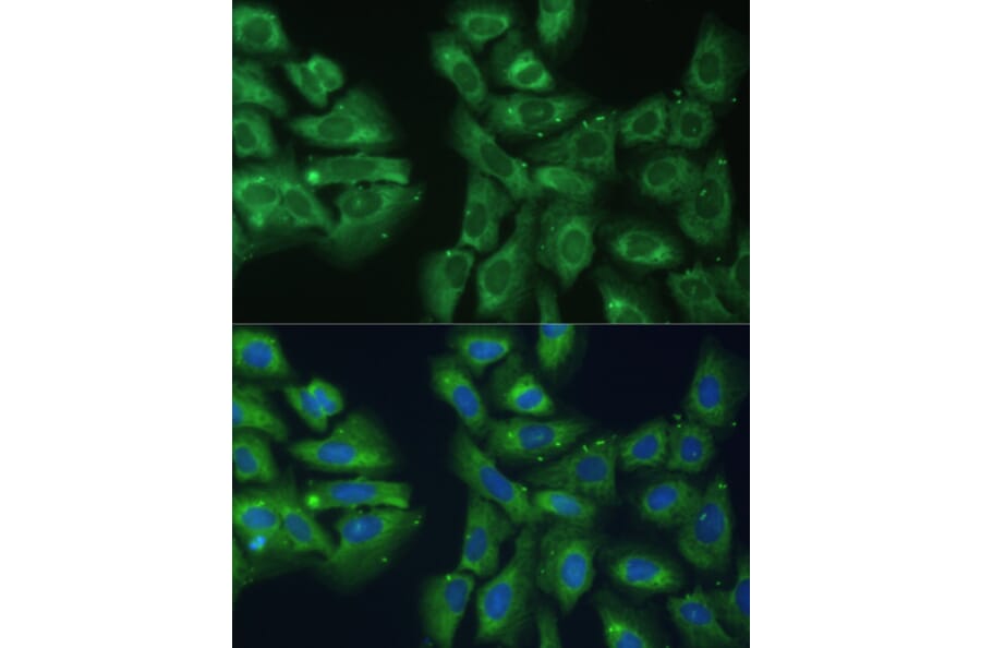 Immunofluorescence - Anti-EIF3D Antibody (A80439) - Antibodies.com