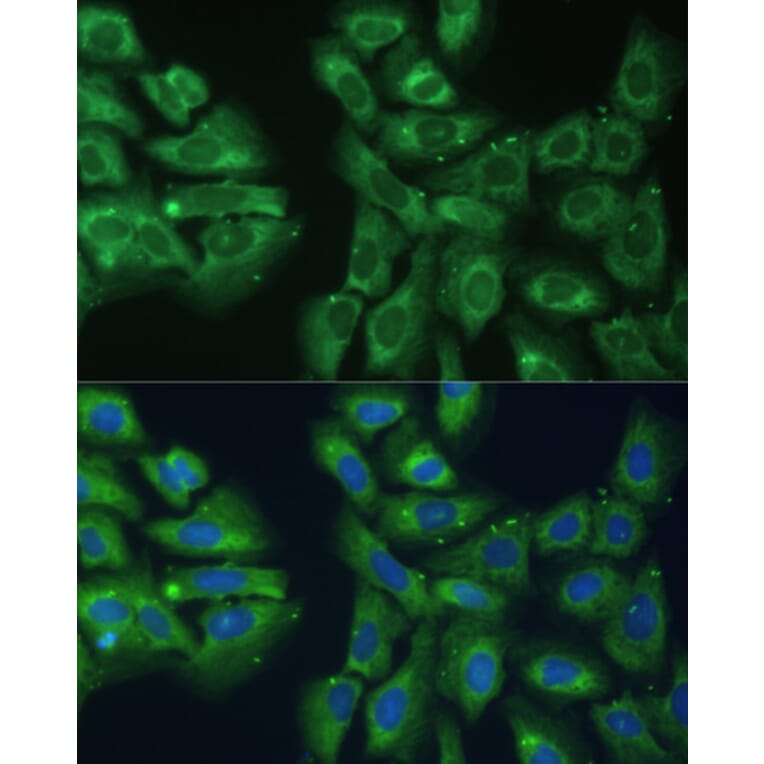 Immunofluorescence - Anti-EIF3D Antibody (A80439) - Antibodies.com