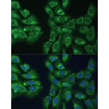 Immunofluorescence - Anti-EIF3D Antibody (A80439) - Antibodies.com