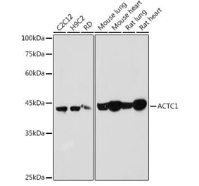 Western Blot - Anti-ACTC1 Antibody (A80440) - Antibodies.com