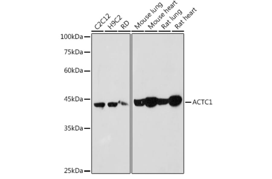 Western Blot - Anti-ACTC1 Antibody (A80440) - Antibodies.com