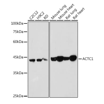 Western Blot - Anti-ACTC1 Antibody (A80440) - Antibodies.com