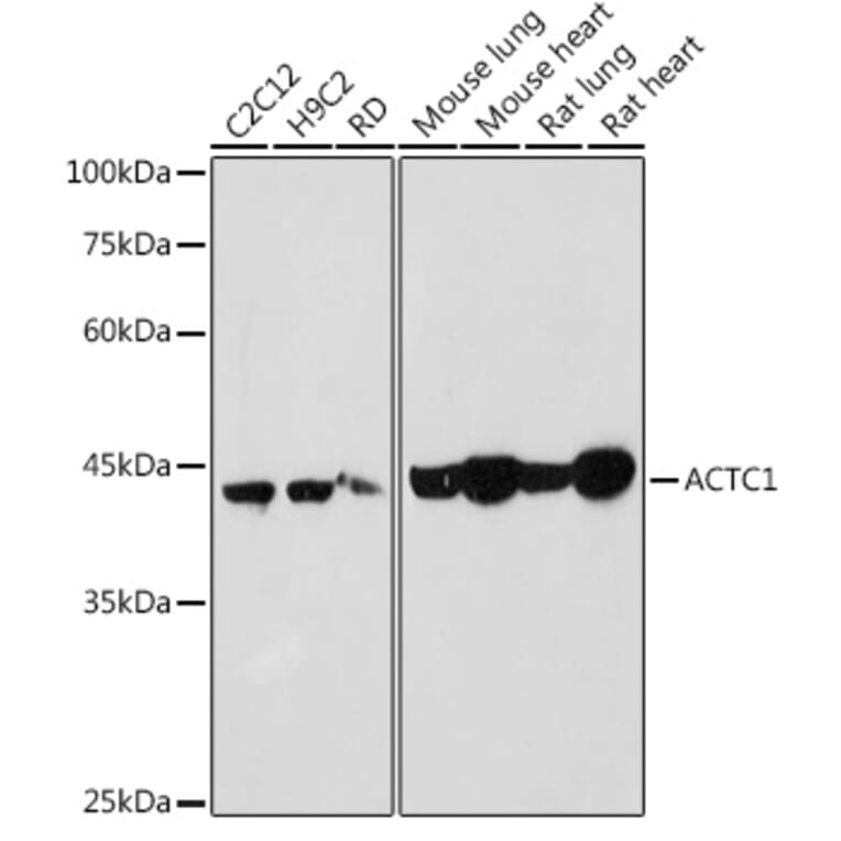 Western Blot - Anti-ACTC1 Antibody (A80440) - Antibodies.com