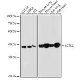 Western Blot - Anti-ACTC1 Antibody (A80440) - Antibodies.com