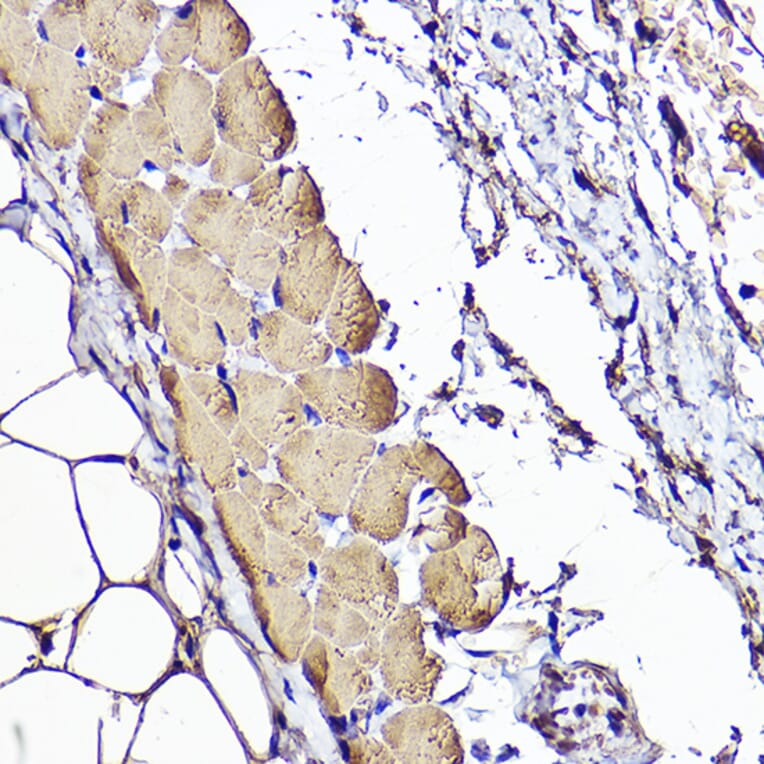 Immunohistochemistry - Anti-ACTC1 Antibody (A80440) - Antibodies.com