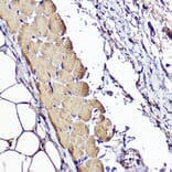 Immunohistochemistry - Anti-ACTC1 Antibody (A80440) - Antibodies.com