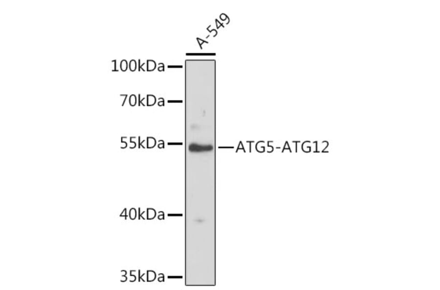Western Blot - Anti-ATG12 Antibody (A8033) - Antibodies.com
