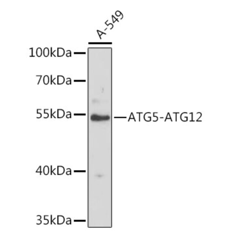 Western Blot - Anti-ATG12 Antibody (A8033) - Antibodies.com