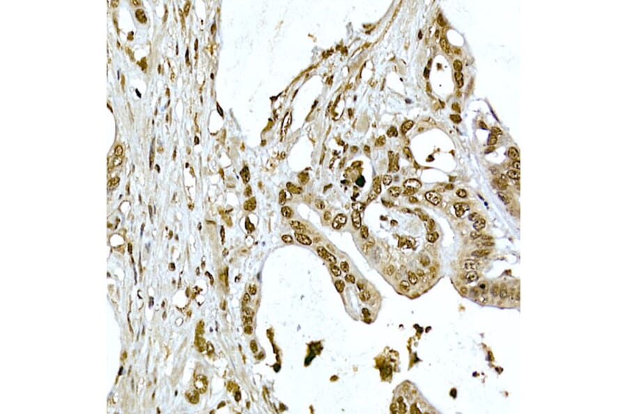 Immunohistochemistry - Anti-AKT1 Antibody (A80442) - Antibodies.com